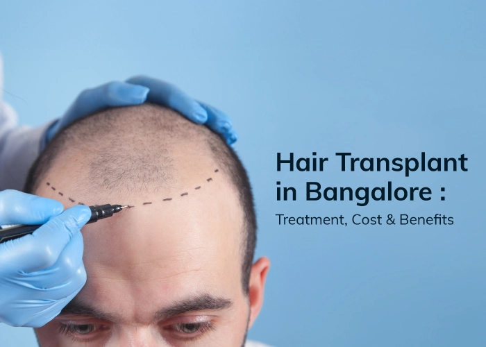 hair transplant clinic Bangalore

